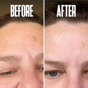 Save 18% on The Skin Care Solution For Dark Spots, Razor Bumps, Ingrown Hair & Razor Burns – Includes Our Ultra Potent Bri...