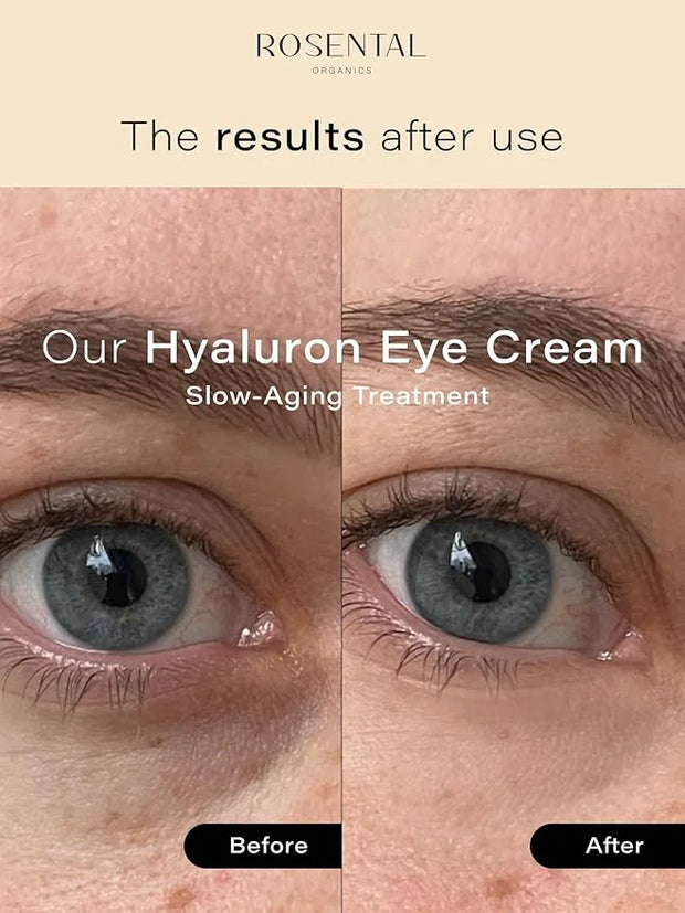 Organics Organic Eye Cream for All Skin Types, 15ml (0.5 fl. oz) (Hyaluron Eye Cream, 15ml) - Product Image