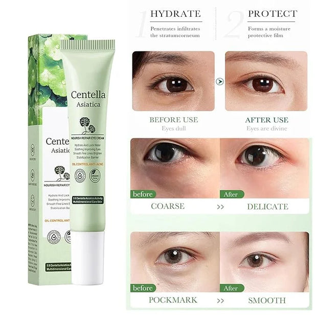 Centella Asiatica Eye Cream,Moisturizes and Tightens the Skin Around the Eyes,Reduces Dry Lines and Fine Lines,Improves Da...