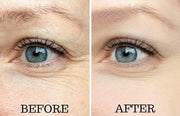 Osmotics Under Eye Rejuvenator, Anti Aging Eye Cream For Dark Circles, Eye Bags, Fine Lines, Puffiness. Best Anti Aging Ey...