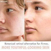 Bio Retinol Alternative Bakuchiol Serum - Smooths Skin & Reduces Fine Lines, USA Made with Natural & Organic Ingredients, ...