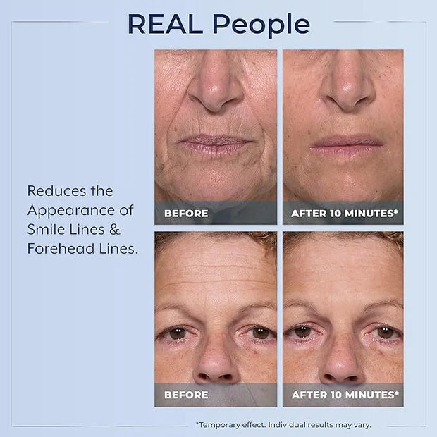 Plexaderm Rapid Reduction Eye Serum - Visibly Reduces Under-Eye Bags, Wrinkles, Dark Circles, Fine Lines & Crow's Feet Ins...