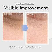 NOWATER Collagen Eye Cream for Wrinkles, Puffiness, Dark Circles - Hydrolyzed Collagen & Beta-glucan for Improved Under-ey...