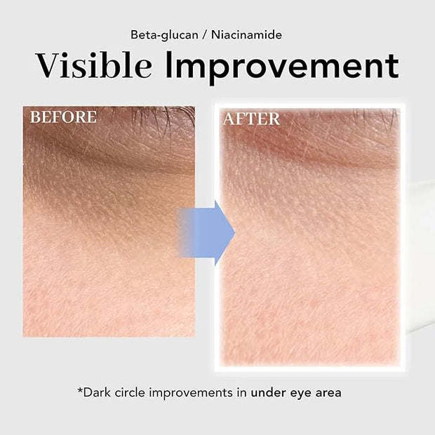 NOWATER Collagen Eye Cream for Wrinkles, Puffiness, Dark Circles - Hydrolyzed Collagen & Beta-glucan for Improved Under-ey...