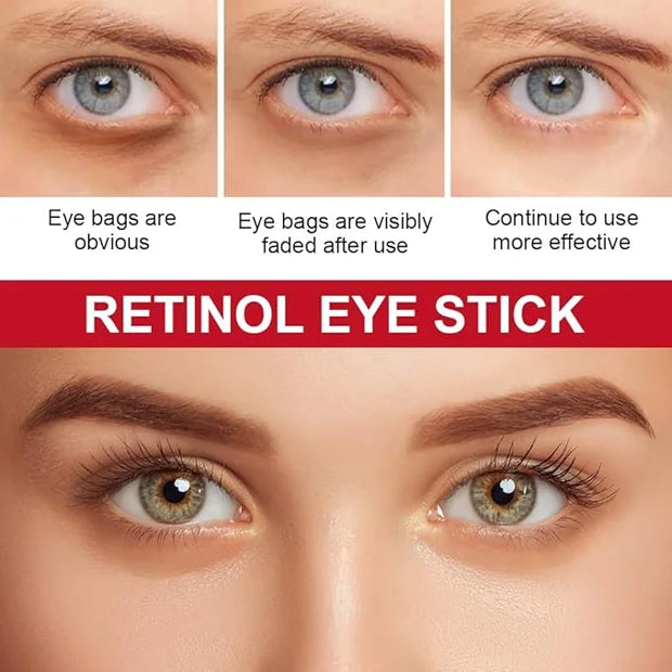 Retinol Eye Stick with Collagen,Hyaluronic Acid for Dark Circle, Wrinkles,Eye Balm Moisturizes Anti Aging,Visible Results ...