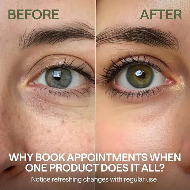 Eye Cream with Caffeine - Hyaluronic Acid and Niacinamide Serum - Face Puffiness Reducer - Product Image