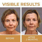 ABERA Natural Repair Eye Cream, Minimizes Under Eye Bags & Puffiness, Reduce Wrinkles, Fine Lines and Dark Circles, 0.5 fl...