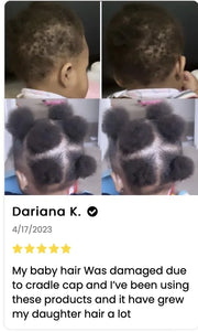 J'Organic Solutions Natural Kid's Hair Growth Stimulator (Hair Grease) with Lanolin, Sweet Almond Oil, and Castor Oil for ...