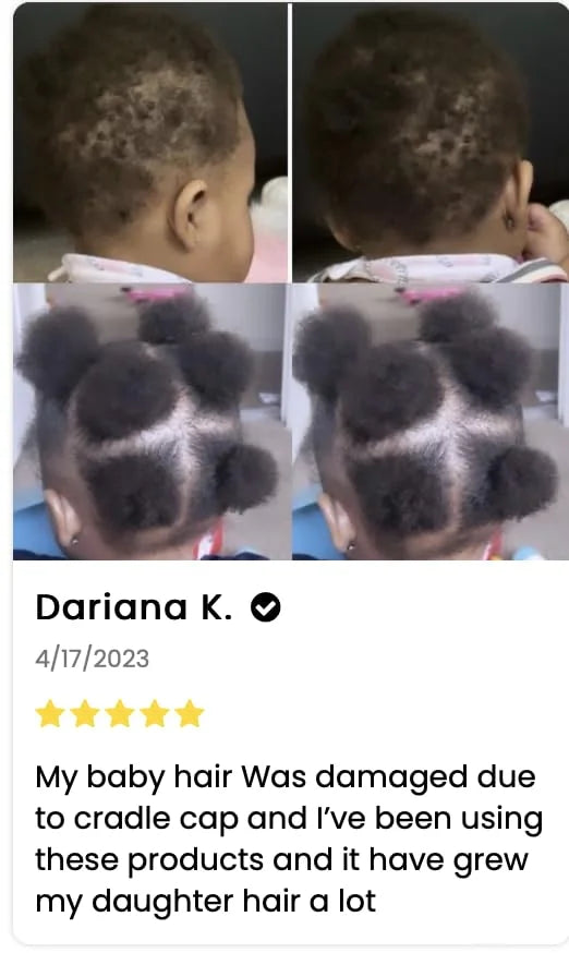 J'Organic Solutions Natural Kid's Hair Growth Stimulator (Hair Grease) with Lanolin, Sweet Almond Oil, and Castor Oil for ...
