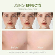 Green Tea Skin Care Kit Teenage Girls Gifts, 19-In-1 Facial Skin Care Routine Set Kit for Women/Girls, Hydrating Teen Skin...