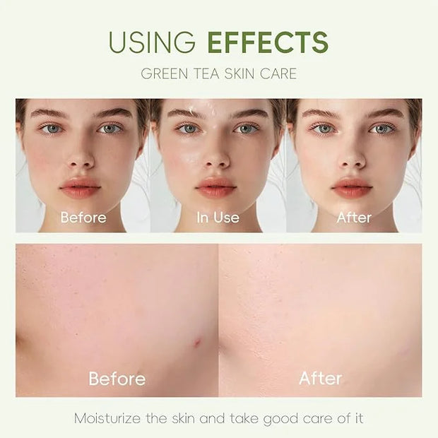 Green Tea Skin Care Kit Teenage Girls Gifts, 19-In-1 Facial Skin Care Routine Set Kit for Women/Girls, Hydrating Teen Skin...