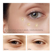 Retinol Eye Serum, Anti-Aging with Hyaluronic Acid Vitamin E Ceramide for Dark Circle, Fine Lines & Under Eye Bags Visibly...