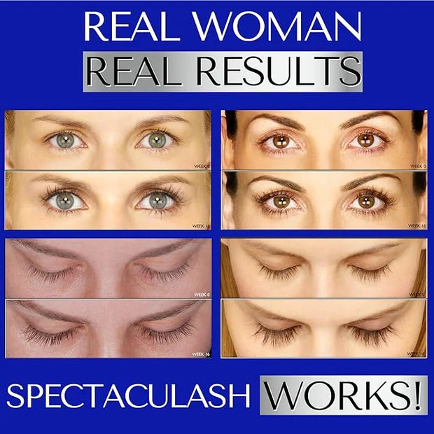 SPECTACULASH RAPID LASH SERUM for Eyelash Growth Serum to Grow Long Natural Lashes – Grow Long Eye Lashes – Lash Condition...