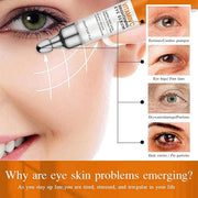 Vitamin C Eye Cream For Dark Circles, Under Eye Bag Cream Anti Aging Firming Creams For Women, Hydrating Eye Moisturizer C...