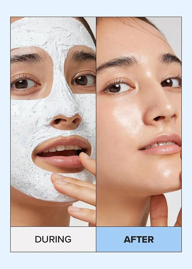 I DEW CARE Wash Off Face Mask - Cake My Day | With Hyaluronic Acid, Self Skin Care, Facial Treatment, Vegan, Cruelty-Free,...