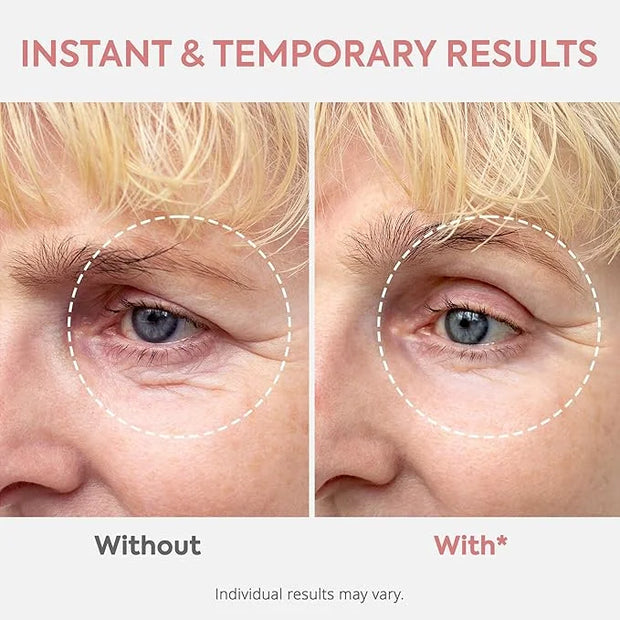 Instant Eye & Face Lift Cream: Rapid Under Eye Bags Wrinkle Smile Lines Forehead Lines Remover - Temporary Firming & Tight...