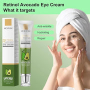 Retinol Avocado Eye Cream Serum - Hydrating Anti-Aging Treatment for Dark Circles, Puffiness, Fine Lines - Overnight Skin ...
