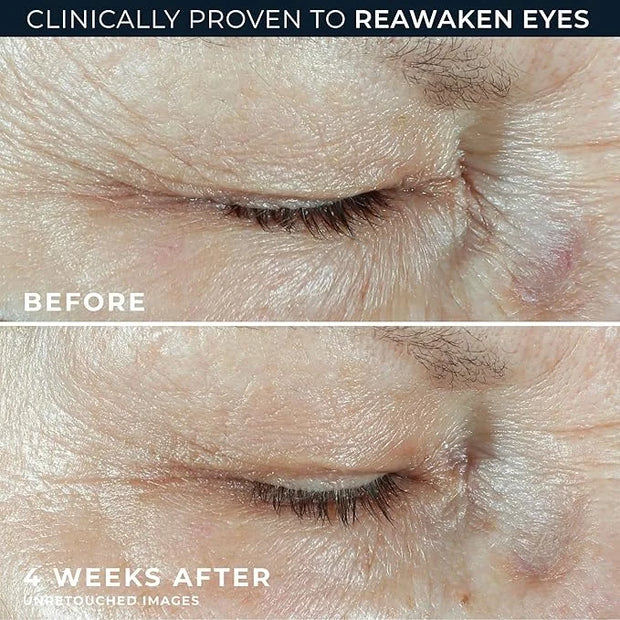 RoC Multi Correxion Hyaluronic Acid Anti Aging Under Eye Cream for Puffiness & Dark Circles (.5 OZ) + RoC Retinol Capsules...
