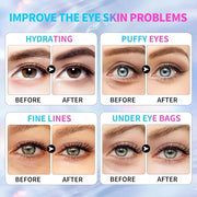 Multi-Colored Collagen Spa Under Eye Mask, 20 Pairs - Under Eye Patches for Puffy Eyes&Dark Circle Dry Skin, Reduce Fine L...