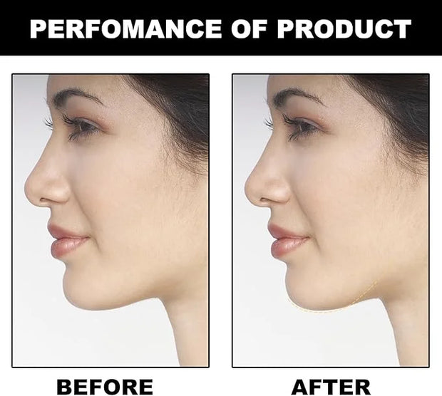 Jaw Exerciser for Men & Women Gokano Jawline - Product Image