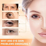 Revive + Glow Vitamin C Eye Balm,Hydrating Eye Cream,Improve Dark Circles,Refreshing and Non-Sticky (2 Pcs) - Product Image