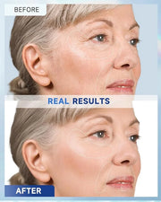 Retinol Cream for Face, Face Moisturizer with Collagen & Hyaluronic Acid, Anti Aging Neck Cream for Tightening Skin, Facia...