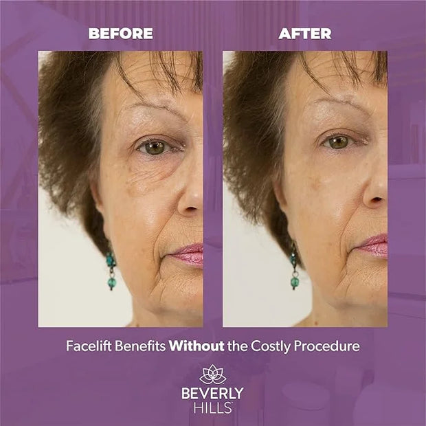Beverly Hills V-lift Instant Eye Lift & Instant Facelift Anti Aging Eye Serum Treatment Bundle with Discount - Serum Treat...
