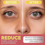 Under Eye Patches for Dark Circles, Puffiness and Eye Bags with 24K Gold - Anti-Wrinkle for Puffy Eyes, Eye Masks with Hya...