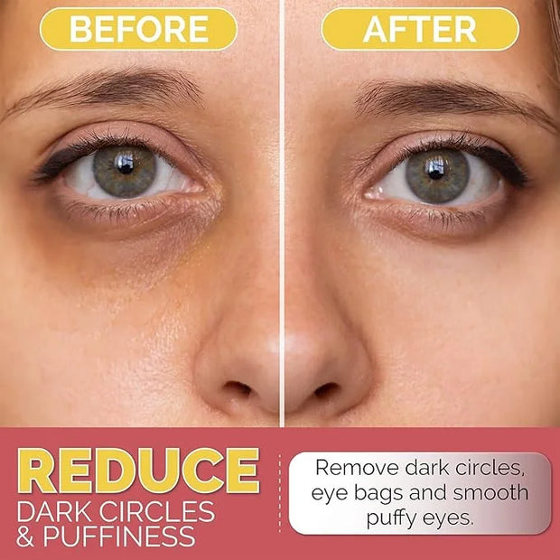 Under Eye Patches for Dark Circles, Puffiness and Eye Bags with 24K Gold - Anti-Wrinkle for Puffy Eyes, Eye Masks with Hya...