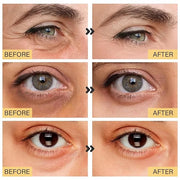 25 Paris Under Eye Patches Eye Mask for Puffy Eyes, Reducing Dark Circles, Anti-Aging & Refreshing, Collagen Eye Mask Eye ...
