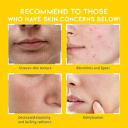 Boosting Toner Pads for Face Oily Skin Korean, #OOTD Vitamin C Niacinamide Heartleaf Hydrating Calming Redness, Vitamin C ...