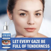 ITECFREELY Stye Eye Treatment, Natural Stye Eye Relief Drops Serum for Styes Chalazion and Blepharitis, Fast Chalazion Rem...