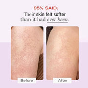 First Aid Beauty KP Bump Eraser Body Scrub 2 oz