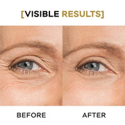 Moisturizing Eye Cream w/Aloe Vera, Collagen, Hyaluronic Acid, Cotton Stem Cells for Dark Circles, Puffiness & Bags - Unde...
