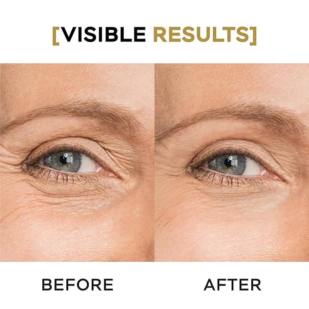 Moisturizing Eye Cream w/Aloe Vera, Collagen, Hyaluronic Acid, Cotton Stem Cells for Dark Circles, Puffiness & Bags - Unde...