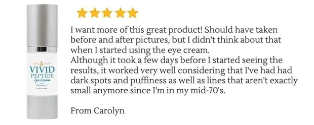 VIVID Peptide Eye Cream with Whitonyl for Dark Circles, Puffiness and Fine Lines - Brightens and Boosts Collagen for Firmn...