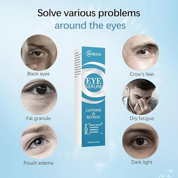 Caffeine Eye Serum, Retinol Eye Firming Serum for Dark Circles and Puffiness, Anti Aging Eye Serum with Hyaluronic Vitamin...