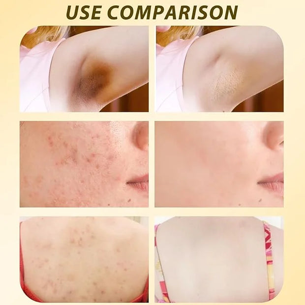 2PCS Bee Venom Comprehensive Cream,Bee Venom Skin Care Cream，Advanced Bee Venom Therapy Cream for All Skin Types - Product...