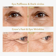 Ginseng Plus Retinal Eye Serum with Retinal Niacinamide Bakuchiol Correction for Puffy Eye Bags Fine Lines Dark Circles Wr...