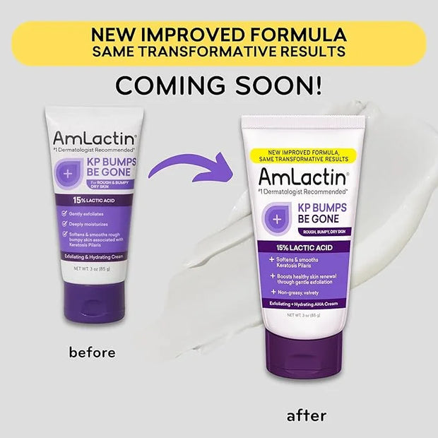 AmLactin KP Bumps Be Gone - 3 oz Keratosis Pilaris Moisturizing Cream with 15% Lactic Acid - Exfoliator and Moisturizer fo...