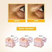 SKIN CARE - Eye Serum with Vitamin C & E, Hyaluronic Acid, Caffeine, and Swiss Apple Stem Cells - Day & Night - Product Image