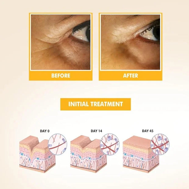 SKIN CARE - Eye Serum with Vitamin C & E, Hyaluronic Acid, Caffeine, and Swiss Apple Stem Cells - Day & Night - Product Image