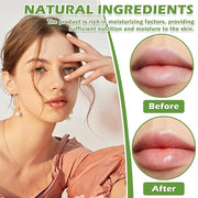 Honey Pot Lip Balm,3PCS Bee Lip (Honey+Apple+Cherry)