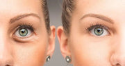 Su-Skin Anti Aging Eye Cream, Bright Eyes, Daily Wrinkle Cream for Firming, Dark Circles, Puffiness - Product Image