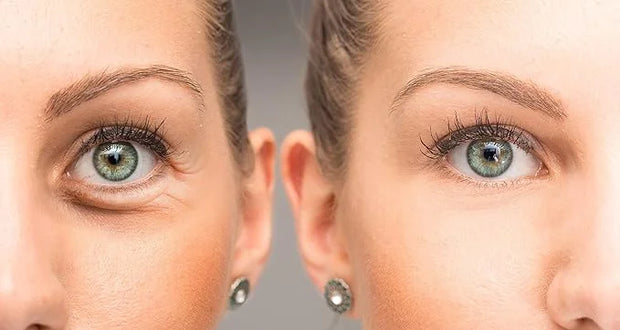 Su-Skin Anti Aging Eye Cream, Bright Eyes, Daily Wrinkle Cream for Firming, Dark Circles, Puffiness - Product Image