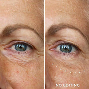 Wunderlift 60 Second Wrinkle Reducer & Wunderlift Night Retinol Eye Cream, Contains Retinol, Hyaluronic Acid - Product Image