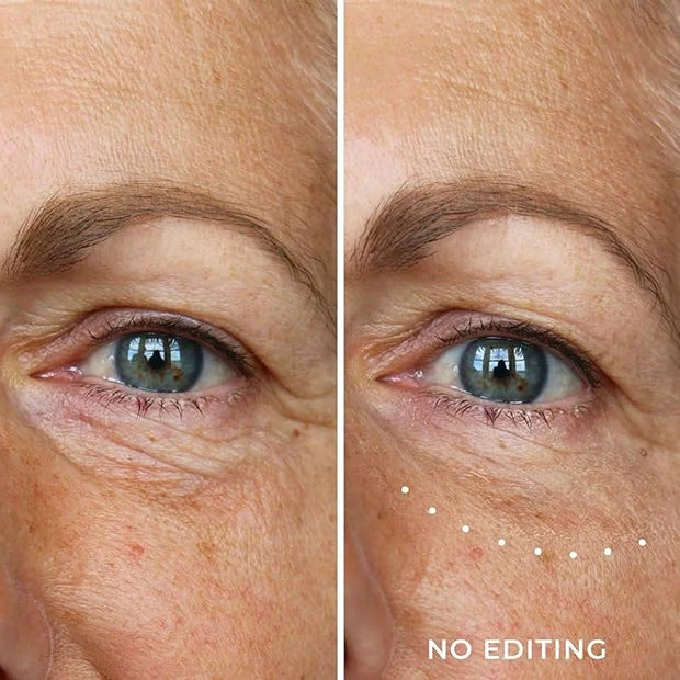 Wunderlift 60 Second Wrinkle Reducer & Wunderlift Night Retinol Eye Cream, Contains Retinol, Hyaluronic Acid - Product Image