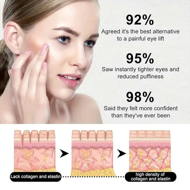 Banana Eye Cream, Anti Aging Eye Cream for Fine Lines Eye Bags Dark Circles and Puffiness,Hydrating Under Eye Cream, with ...