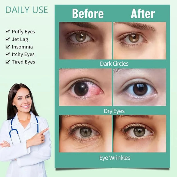Serfeymi 10 Packs Steam Eye Masks Relief Eye Fatigue, Eye Patch Warm Eye Mask, Hot Compress Disposable Eye SPA Heated Eye ...