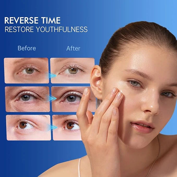 6% Caffeine Eye Cream for Dark Circles - Rapid Wrinkle Repair, Daily 1% Retinol & Hyaluronic Acid to Fight Fine Lines, Wri...